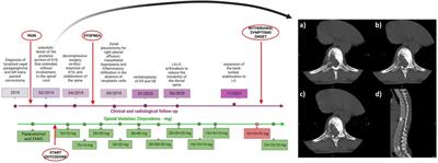 Case report: The lesson from opioid withdrawal symptoms mimicking paraganglioma recurrence during opioid deprescribing in cancer pain